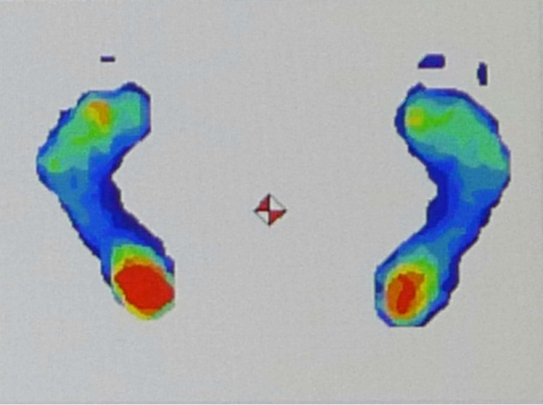 neutral gait foot map